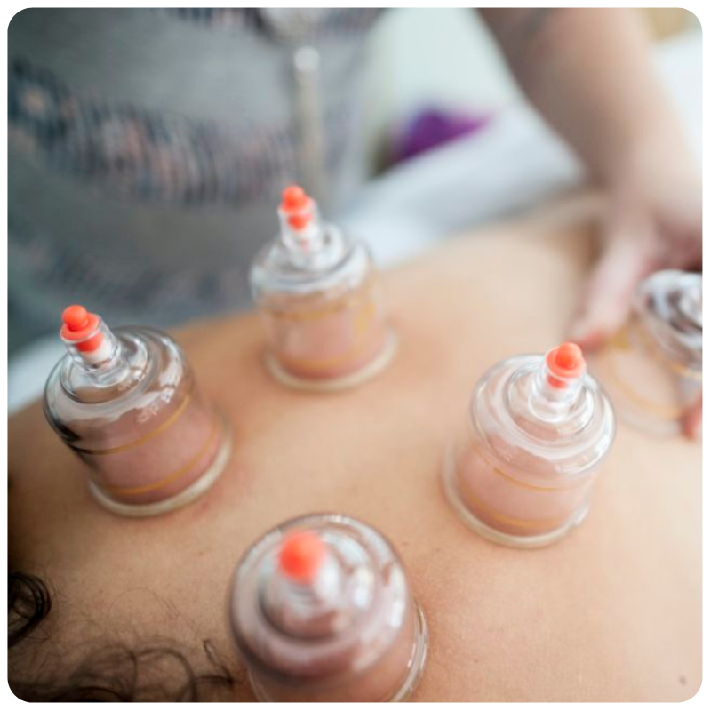 Cupping Therapy Massage
