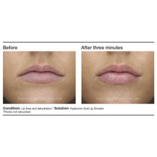 Load image into Gallery viewer, Hyaluronic Acid Lip Booster